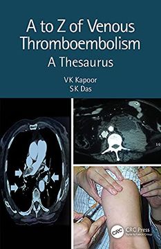 portada A to z of Venous Thromboembolism: A Thesaurus (en Inglés)