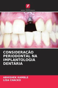 portada Consideraã â ã â o Periodontal na Implantologia Dentã â ria