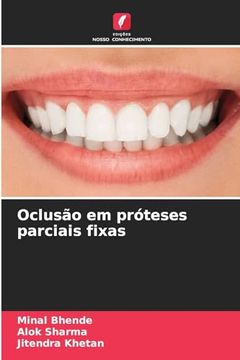 portada Oclusão em Próteses Parciais Fixas (en Portugués)