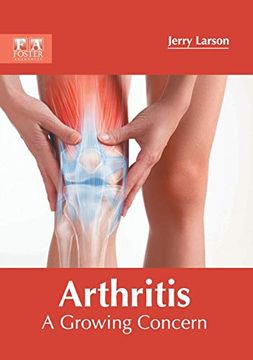 portada Arthritis: A Growing Concern (en Inglés)