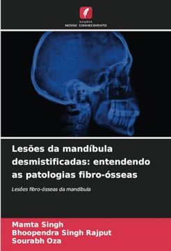 portada Lesões da Mandíbula Desmistificadas: Entendendo as Patologias Fibro-Ósseas: Lesões Fibro-Ósseas da Mandíbula (en Portugués)