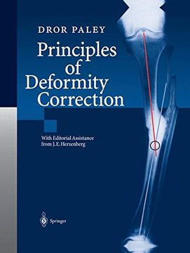 portada Principles of Deformity Correction