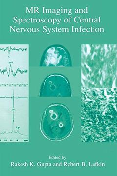 portada Mr Imaging and Spectroscopy of Central Nervous System Infection (in English)