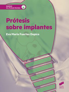 portada Prótesis Sobre Implantes (in Spanish)