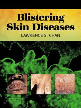 portada Blistering Skin Diseases (en Inglés)