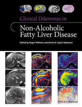 portada Clinical Dilemmas in Non-Alcoholic Fatty Liver Disease