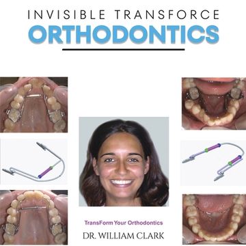 portada Invisible TransForce Orthodontics (in English)