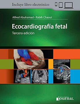 portada Ecocardiografia Fetal