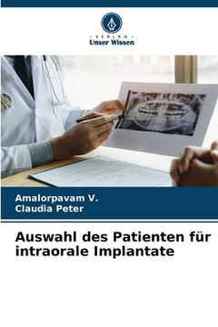 portada Auswahl des Patienten für intraorale Implantate (en Alemán)
