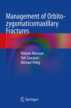 portada Management of Orbito-Zygomaticomaxillary Fractures (in English)