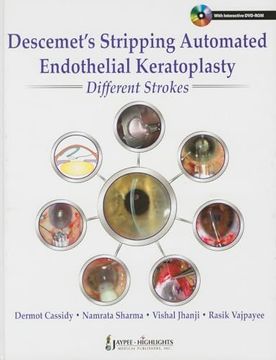 portada Descemet's Stripping Automated Endothelial Keratoplasty Different Strokes