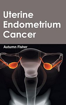 portada Uterine Endometrium Cancer (en Inglés)
