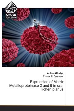 portada Expression of Matrix Metalloproteinase 2 and 9 in oral lichen planus (in English)