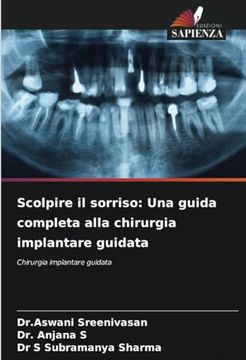 portada Scolpire il Sorriso: Una Guida Completa Alla Chirurgia Implantare Guidata (en Italiano)