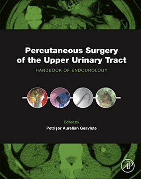 portada Percutaneous Surgery of the Upper Urinary Tract: Handbook of Endourology