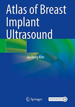 portada Atlas of Breast Implant Ultrasound (en Inglés)