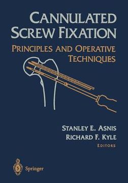 portada cannulated screw fixation: principles and operative techniques