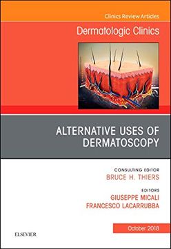 portada Alternative Uses of Dermatoscopy, an Issue of Dermatologic Clinics, 1e (The Clinics: Dermatology) (en Inglés)