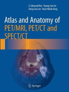portada Atlas and Anatomy of Pet/Mri, Pet/CT and Spect/CT 