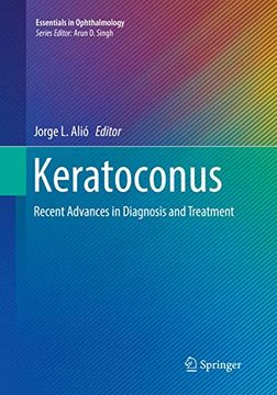 portada Keratoconus: Recent Advances in Diagnosis and Treatment