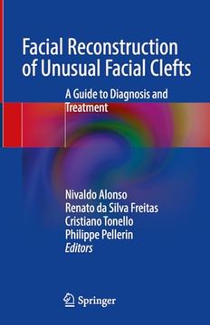 portada Facial Reconstruction of Unusual Facial Clefts: A Guide to Diagnosis and Treatment (en Inglés)