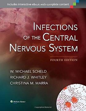portada Infections of the Central Nervous System (en Inglés)
