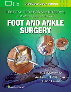 portada Hospital for Special Surgery's Illustrated Tips and Tricks in Foot and Ankle Surgery (en Inglés)