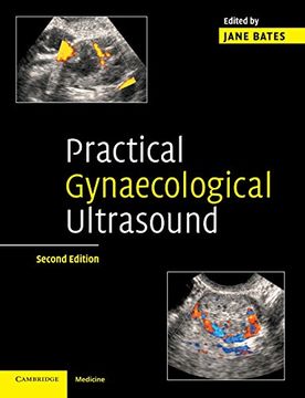 portada Practical Gynaecological Ultrasound (en Inglés)