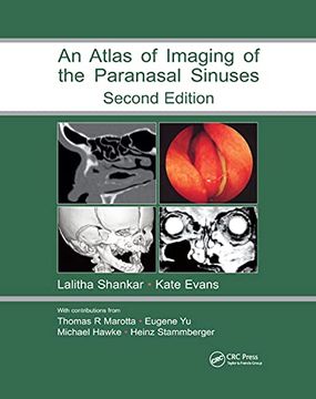 portada An Atlas of Imaging of the Paranasal Sinuses, Second Edition (en Inglés)