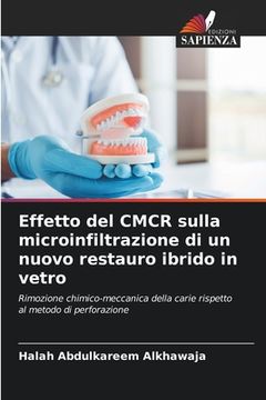 portada Effetto del CMCR sulla microinfiltrazione di un nuovo restauro ibrido in vetro (en Italiano)