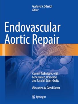portada Endovascular Aortic Repair: Current Techniques with Fenestrated, Branched and Parallel Stent-Grafts (en Inglés)