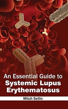 portada Essential Guide to Systemic Lupus Erythematosus (en Inglés)