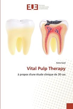 portada Vital Pulp Therapy (in French)