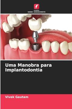 portada Uma Manobra Para Implantodontia (en Portugués)