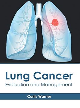 portada Lung Cancer: Evaluation and Management