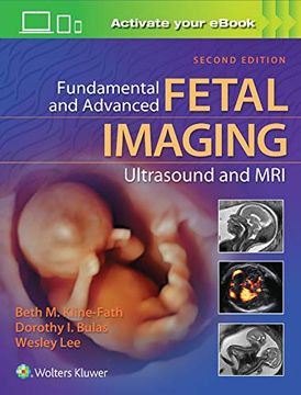 portada Fundamental and Advanced Fetal Imaging Ultrasound and MRI (en Inglés)