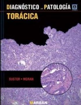 Libro Diagnóstico En Patología. Torácica De Suster - Buscalibre