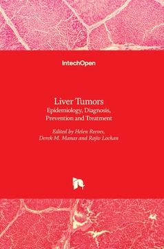 portada Liver Tumors: Epidemiology, Diagnosis, Prevention and Treatment (en Inglés)
