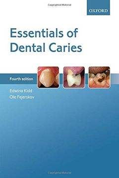 portada Essentials Of Dental Caries (en Inglés)