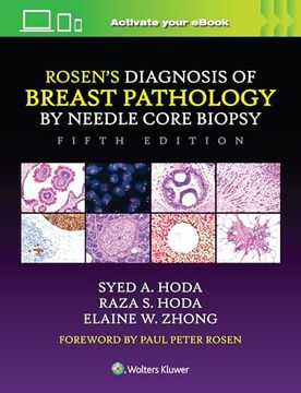 portada Rosen's Diagnosis of Breast Pathology by Needle Core Biopsy (in English)