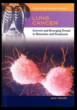 portada Lung Cancer: Current and Emerging Trends in Detection and Treatment (en Inglés)