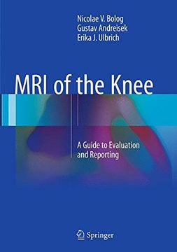 portada MRI of the Knee: A Guide to Evaluation and Reporting (en Inglés)