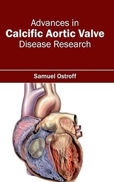 portada Advances in Calcific Aortic Valve Disease Research (in English)
