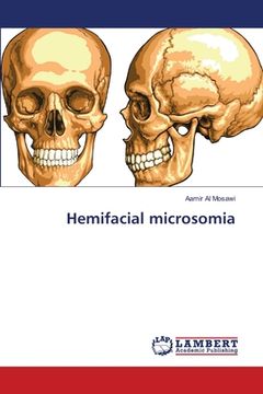 portada Hemifacial microsomia (en Inglés)