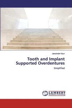 portada Tooth and Implant Supported Overdentures (en Inglés)