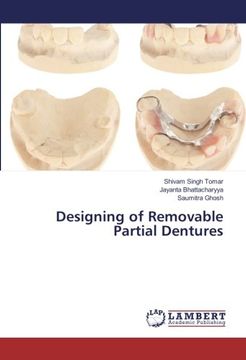portada Designing of Removable Partial Dentures