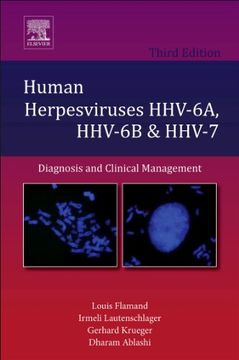 portada Human Herpesviruses Hhv-6A, Hhv-6B & Hhv-7: Diagnosis and Clinical Management(Elsevier Science & Technology) (in English)