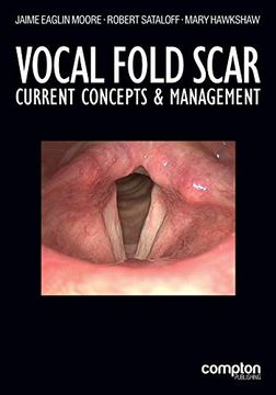 portada Vocal Fold Scar: Current Concepts and Management (en Inglés)