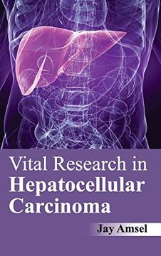 portada Vital Research in Hepatocellular Carcinoma (en Inglés)