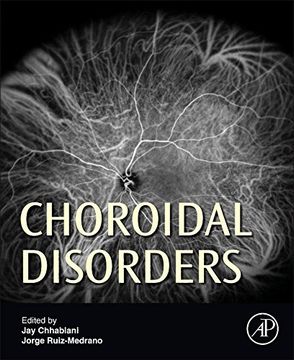 portada Choroidal Disorders
